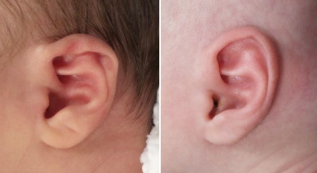 baby ears fold over